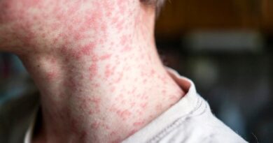 Measles is making a comeback in Canada. What’s driving the surge? – National