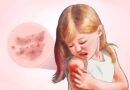 sintomas, causas, tratamentos e abordagens naturais