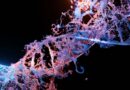 Drug May Repair DNA at Earliest Stages of Alzheimer’s – And it’s Already Passed Safety Trials